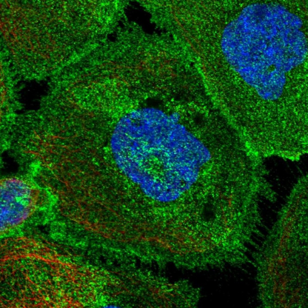 Anti-ATP2B4