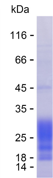 Recombinant Human WBP2 Protein