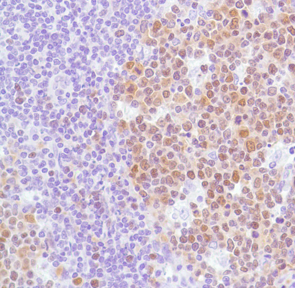 Anti-BCL-6, clone SP155