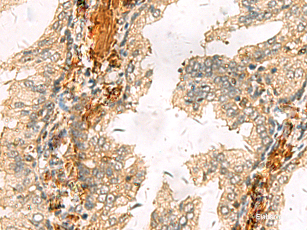 Anti-ACTC1