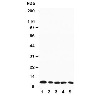 Anti-MIP-1 beta