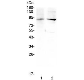 Anti-XPB