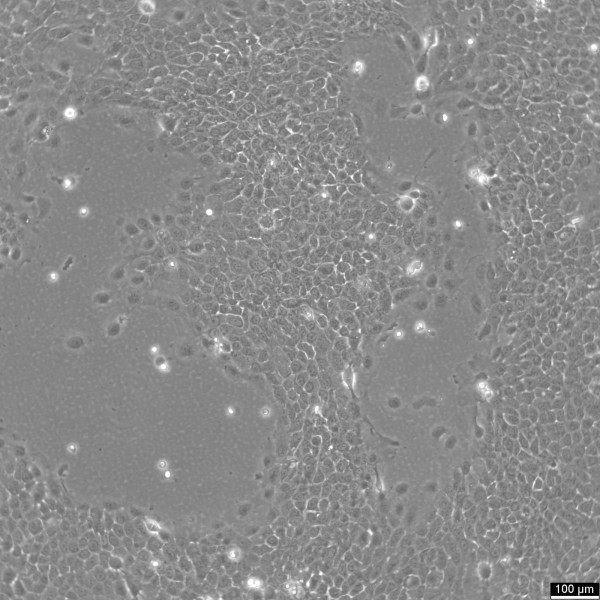SCaBER Cells