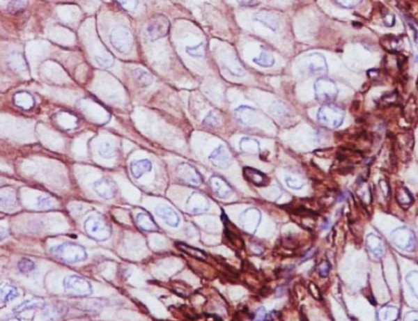 Anti-CD29 / Integrin beta 1
