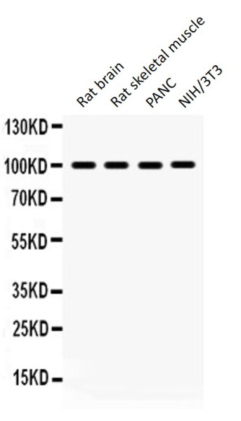 Anti-ERK3