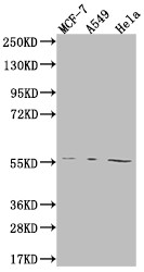 Anti-FADS1 Recombinant Monoclonal, clone 7A10