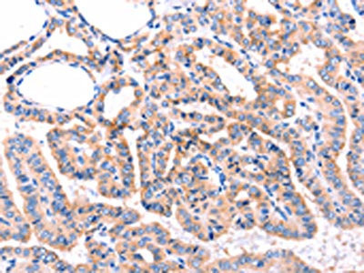 Anti-ADRBK1