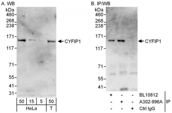 Anti-CYFIP1