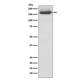 Anti-Neurofilament (-Medium) / NF-M / NEFM, clone AAGI-14