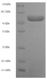 Squamous cell carcinoma antigen recognized by T-cells 3 (SART3), partial, human, recombinant