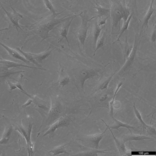 BJ Fibroblast Cells