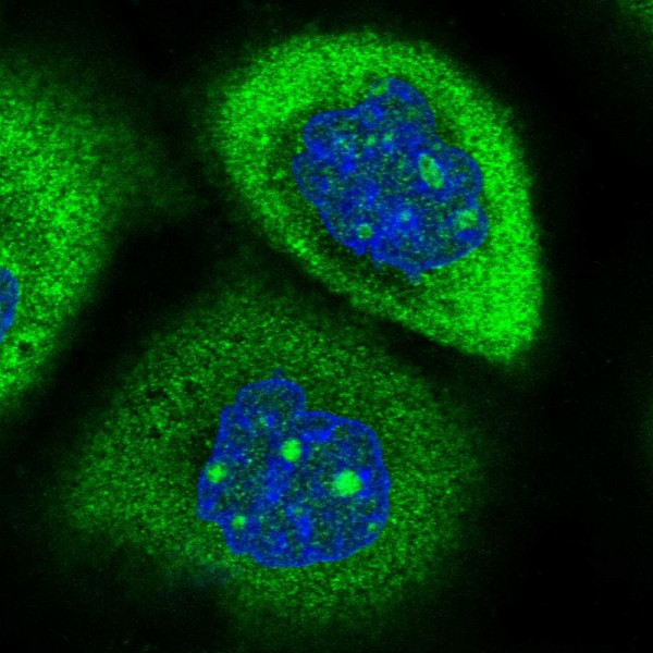 Anti-RPAP2