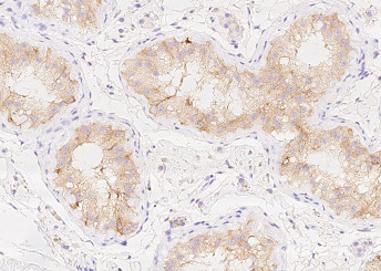 Anti-AMH Monoclonal Recombinant Antibody