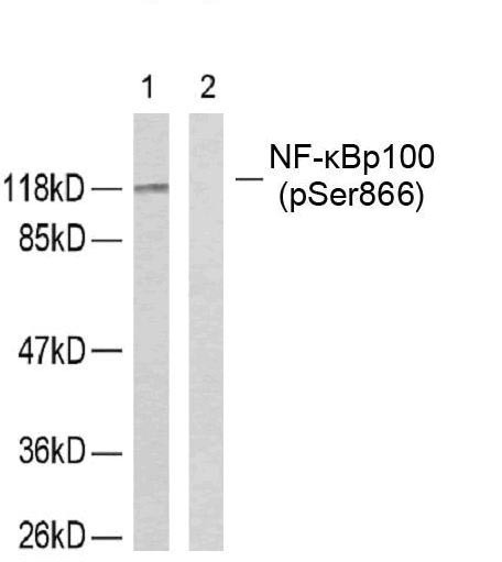 Anti-phospho-NFkB p100/p52 (Ser866)