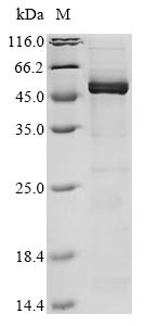 Nucleoprotein (N), human coronavirus 229E, recombinant