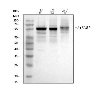 Anti-FOXM1 / Forkhead box protein M1