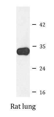 Anti-BTLA / CD272