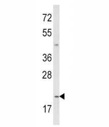 Anti-IL-12