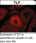 Anti-TLF (TBP like factor)