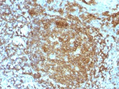 Anti-CD45RA (Leucocyte Marker)(Clone: PTPRC/818)