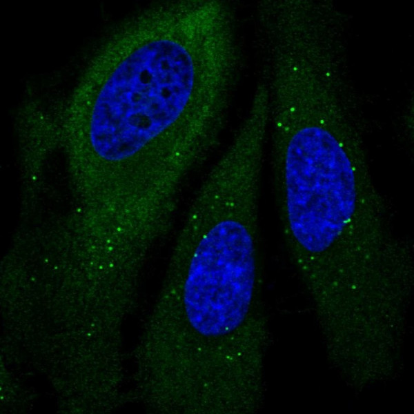 Anti-GSPT1
