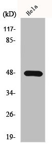Anti-KCNJ2