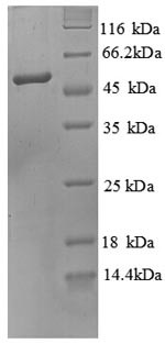 O-phosphoseryl-tRNA (Sec) selenium transferase (SEPSECS), partial, human, recombinant
