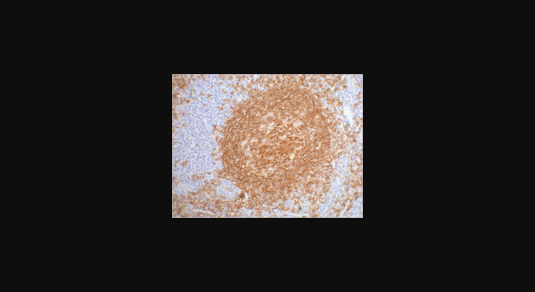 Anti-CD20, monoclonal