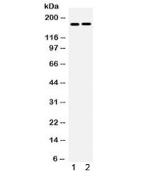 Anti-Ceruloplasmin / CP