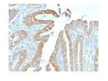 Anti-Cytokeratin 19 (KRT19) (Pancreatic Stem Cell Marker) Recombinant Mouse Monoclonal Antibody (clo