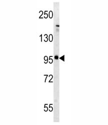 Anti-mGLUR5