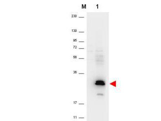 Anti-Macrophage Inflammatory Protein-3alpha (MIP-3alpha)