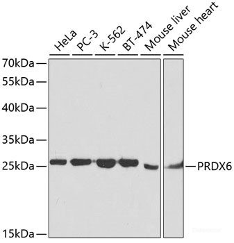 Anti-PRDX6