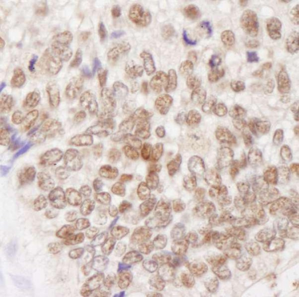 Anti-MSH2 (IHC)