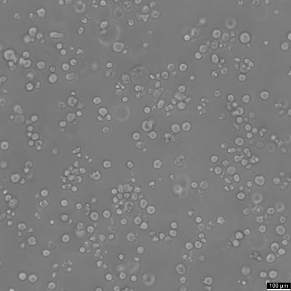 Walker-256 (LLC-WRC 256) Cells