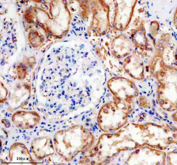 Anti-phospho-Tau pS324, clone 17M40