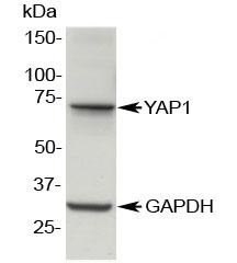 Anti-YAP1