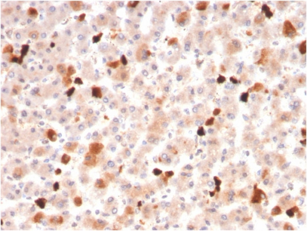 Anti-Apolipoprotein A1 / APOA1, clone APOA1/3661