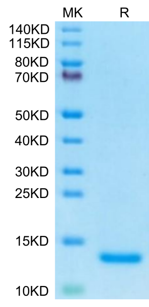Human Complement C5a Protein
