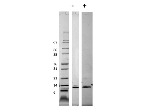 Monocyte Chemotactic Protein-3 (CCL7)