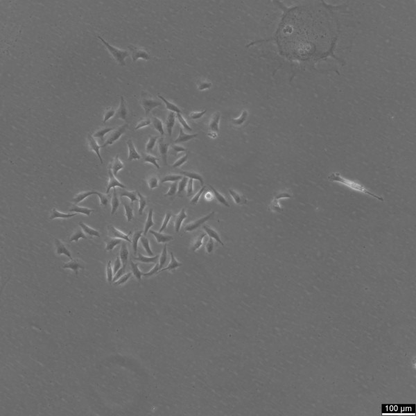 MDA-MB-231-GFP
