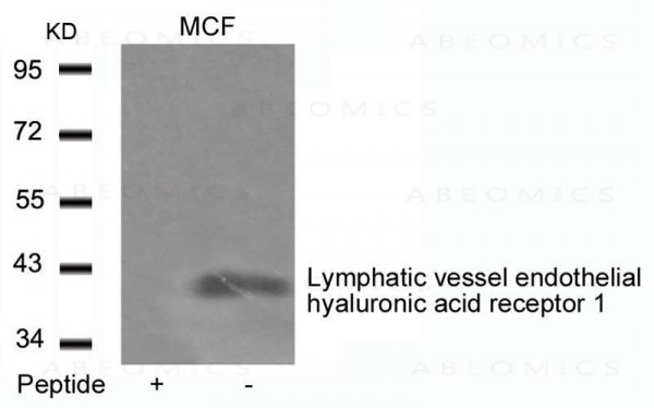 Anti-Lymphatic vessel endothelial hyaluronic acid receptor 1