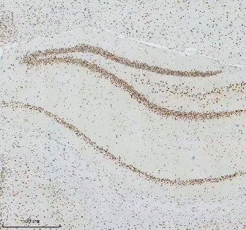 Anti-Cyclin dependent kinase 9 / CDK9, clone GIH-3