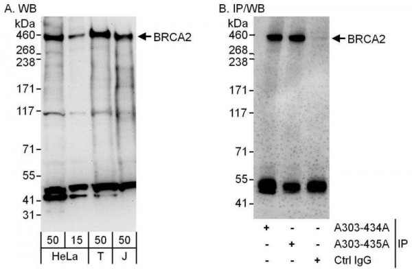 Anti-BRCA2