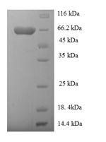 Rab GDP dissociation inhibitor beta (GDI2), human, recombinant