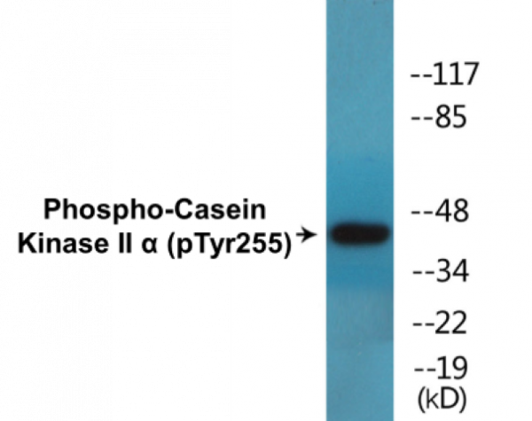 Casein Kinase II alpha (Phospho-Tyr255) Colorimetric Cell-Based ELISA Kit