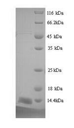 Prostate stem cell antigen (Psca), mouse, recombinant