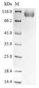 Serine protease inhibitor A3K (Serpina3k), mouse, recombinant