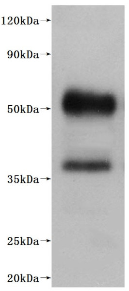 C5a anaphylatoxin chemotactic receptor 1 (C5AR1)-VLPs (Active), human, recombinant