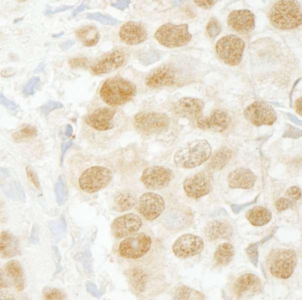 Anti-SFRS2IP (IHC)